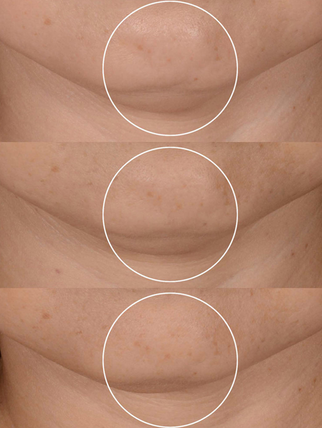 Rénergie H.P.N. 300 -Peptide Cream