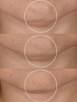Rénergie H.P.N. 300 -Peptide Cream
