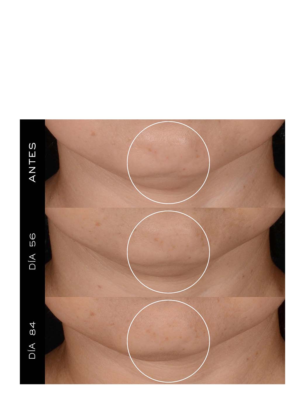 Rénergie H.P.N. 300 -Peptide Cream